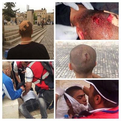 Attaque d'al-Aqsa ce matin par l'occupation : de nombreux blessés, au moins 25 arrestations 